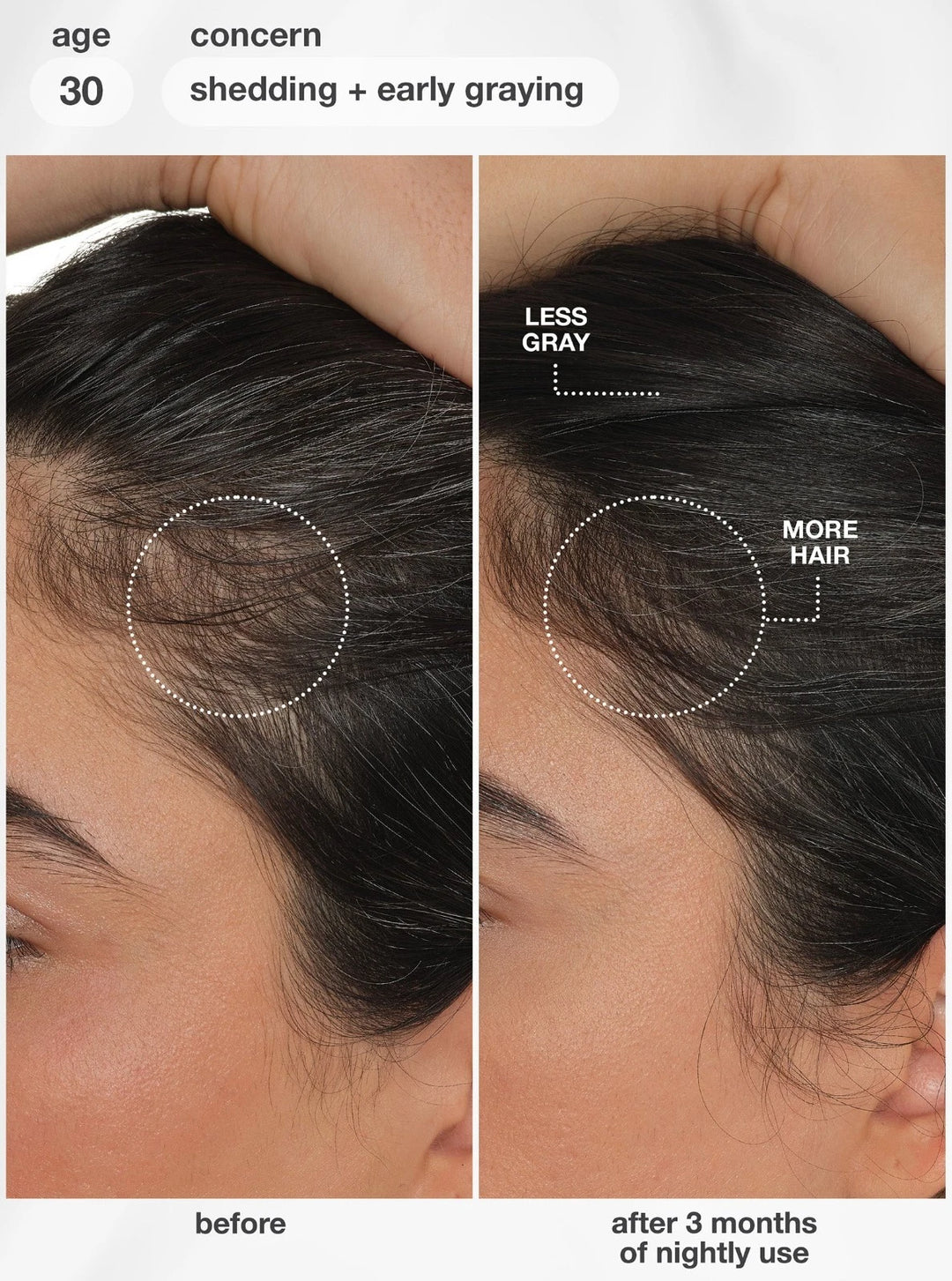 Before and after comparison of hair care product on scalp with text indicating age, concern, and product effect.