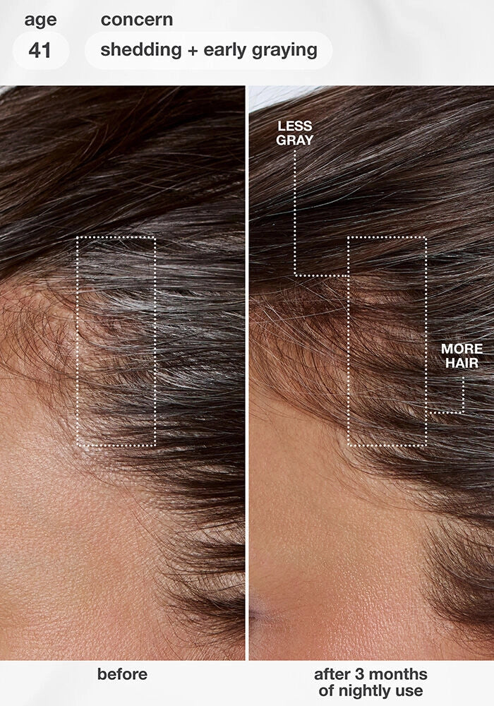 K18 Future IQ Biomimetic Hair Longevity Serum